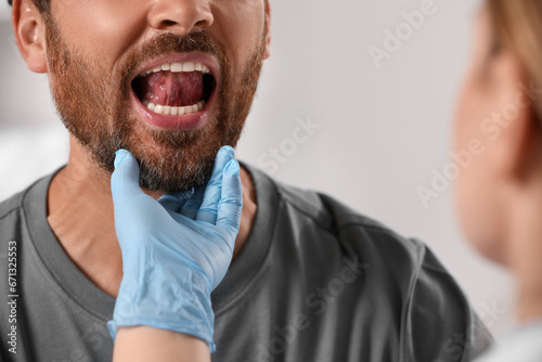 Doctor in medical gloves examining man`s oral cavity on blurred background, closeup photo