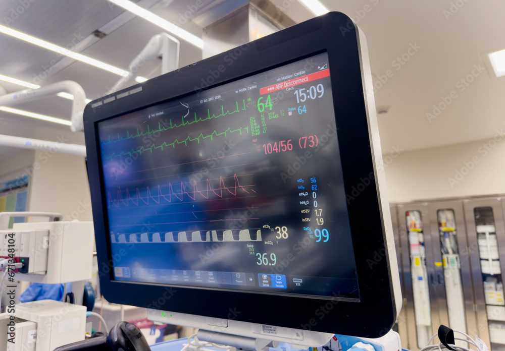 hospital monitor displaying vital signs: blood pressure, heart rate, pulse oximetry, and temperature, providing critical patient health data in a medical setting hospital monitor displaying vital signs: blood pressure, heart rate, pulse oximetry, and temperature, providing critical patient health data in a medical setting
