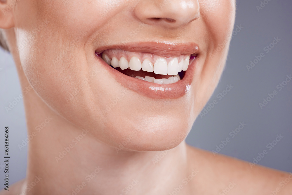 Obraz premium Smile, mouth and teeth whitening of woman in studio, background and wellness. Closeup female model, clean dental and face of fresh breath, happy tooth implant and aesthetic beauty of cosmetic results