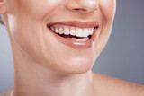 Smile, mouth and teeth whitening of woman in studio, background and wellness. Closeup female model, clean dental and face of fresh breath, happy tooth implant and aesthetic beauty of cosmetic results