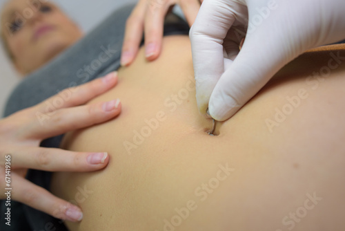 Tableau sur toile Closeup of belly button piercing