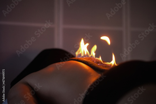 FIre massage alternative therapy. Wellness rehabilitation for patient in medical clinic office. Fire flame on man back in dark room, close up. Rehab relaxing massage concept. Copy ad text space