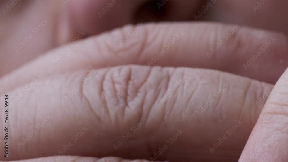 closeup female hands 55 years old with dry skin damage, beauty and skincare in second half life, concept care aging skin, treatment dermatological diseases, hydration and nutrition of epidermis