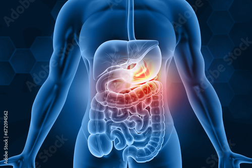 Human stomach pain. digestive problems. 3d illustration.. photo