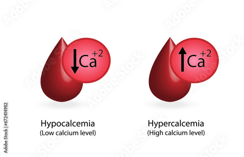 hypercalcemia, high plasma calcium level and hypocalcemia, low plasma calcium level. Calcium excess and deficit electrolyte disorders, blood droplet, Scientific design. Vector illustration.