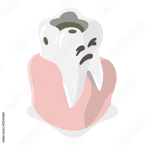 3D Isometric Flat Illustration of Tooth Decay. Item 2