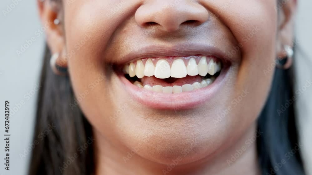 Closeup of the smile of a female student laughing and looking cheerful while standing on campus at a university alone. Zoom of one joyful girl showing off her bright smile and perfect white teeth Closeup of the smile of a female student laughing and looking cheerful while standing on campus at a university alone. Zoom of one joyful girl showing off her bright smile and perfect white teeth