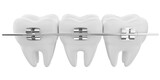 dental braces 3d icon