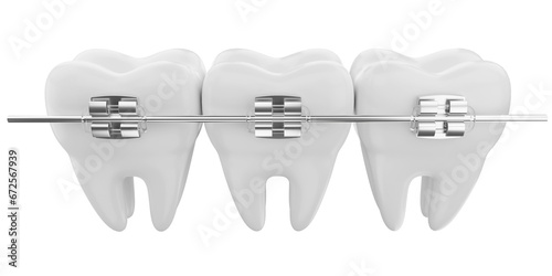 dental braces 3d icon