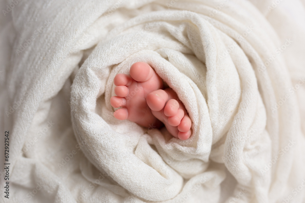 twisted child. Soft feet of a newborn twisted child. Soft feet of a newborn