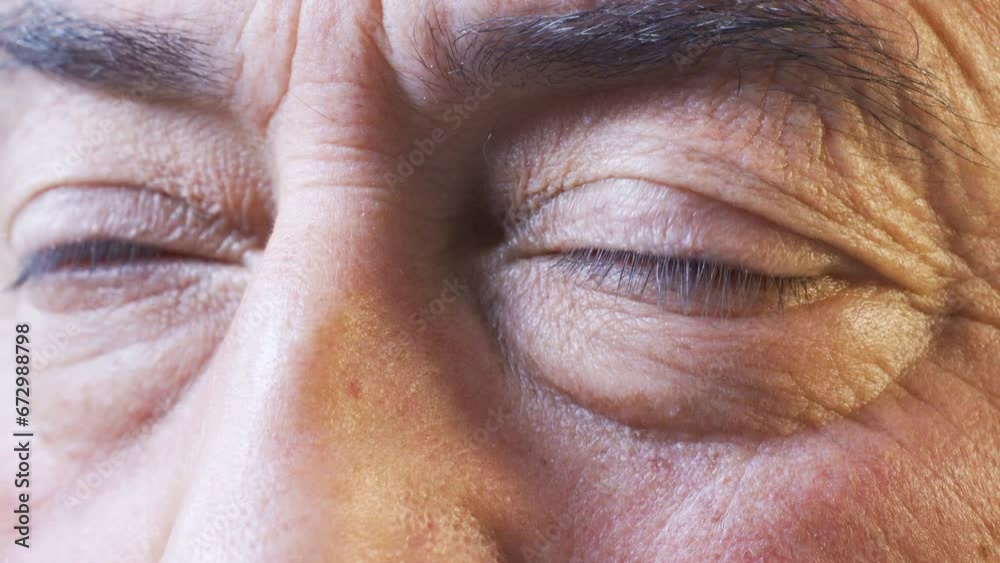 Old and sick male eyes. Old and sick male eyes.