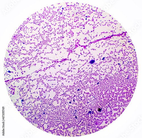 Fotografia Bacterial colonies gram stained microscopic show Staphylococcus aureus  Bacteria