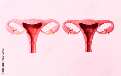 Human uterus model, 3d rendering. photo