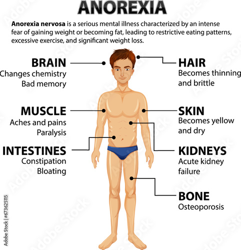 Effects of Anorexia on Male Anatomy