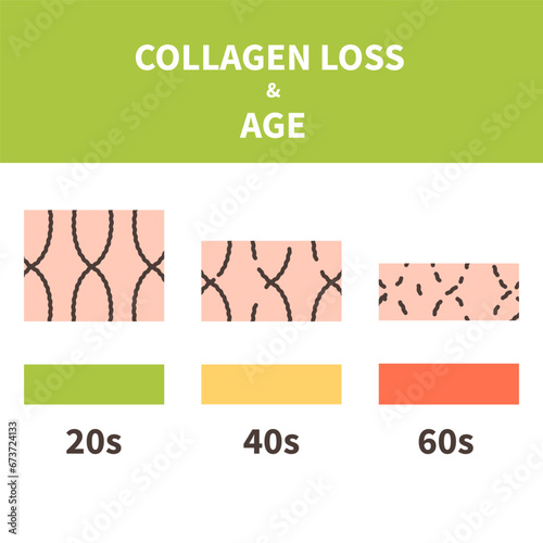 Collagen peptide protein loss process illustration. Cell structure in younger and older skin. Beauty and wellness concept. Medical vector illustration.