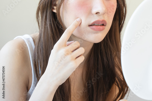 Asian young woman looking face skin in the mirror have a red rash on her face from cosmetic allergy photo