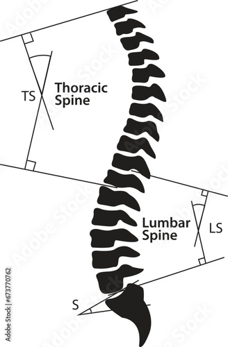 Spinal-pelvic sagittal parameters Line art vector illustration