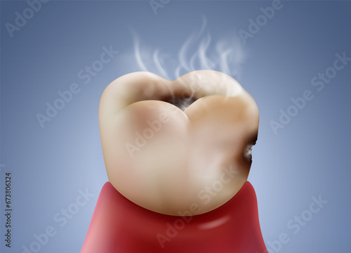 Tooth decay and infection are the causes of bad breath. Realistic vector illustration file.