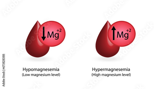 hypermagnesemia, high plasma magnesium level and hypomagnesemia, low plasma magnesium level. magnesium Mg excess and deficit electrolyte disorders, blood test tube, Scientific vector photo