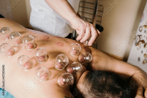 masaż, masażysta, rehabilitacja, relaks, gabinet, zdrowie, fizjoterapia, bańki, stawianie baniek © Agnieszka