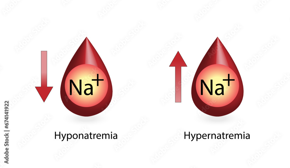 gabapentin hypernatremia