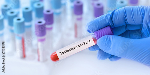 Doctor holding a test blood sample tube with Testosterone test on the background of medical test tubes with analyzes photo