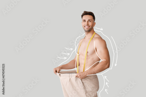 Muscled young man after weight loss on light background photo