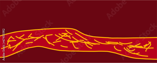 Horizontal dark red background with yellow stripes.