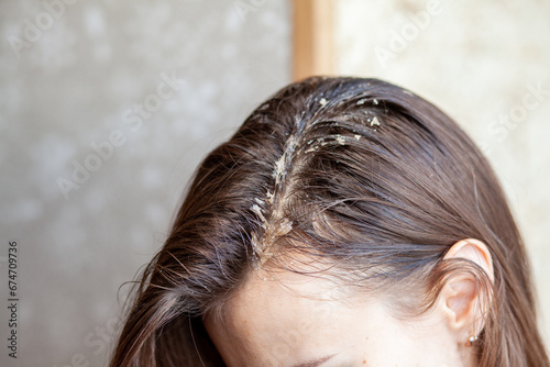 Canvastavla Parting of women's hair on the head