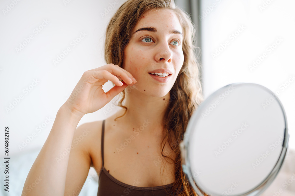 Dermatology. A beautiful woman looking in the mirror, touching her face with her hand, examines acne, pigmentation. Cosmetic care. Allergic reaction. Health concept, cosmetology. Dermatology. A beautiful woman looking in the mirror, touching her face with her hand, examines acne, pigmentation. Cosmetic care. Allergic reaction. Health concept, cosmetology.