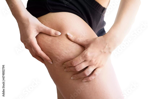 woman touching her cellulite isolated on white background