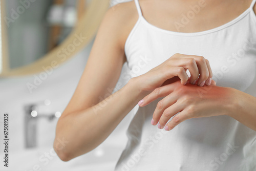 Suffering from allergy. Young woman scratching her hand indoors, closeup photo