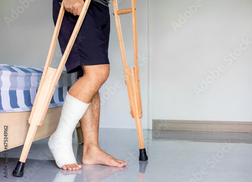 Foto Close-up patient with broken leg in cast and bandage, man with leg splin is walk