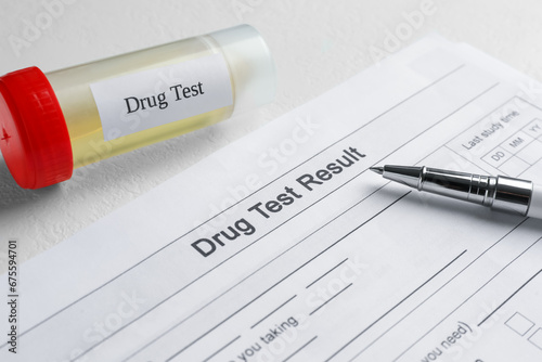 Drug test result form, container with urine sample and pen on light table, closeup