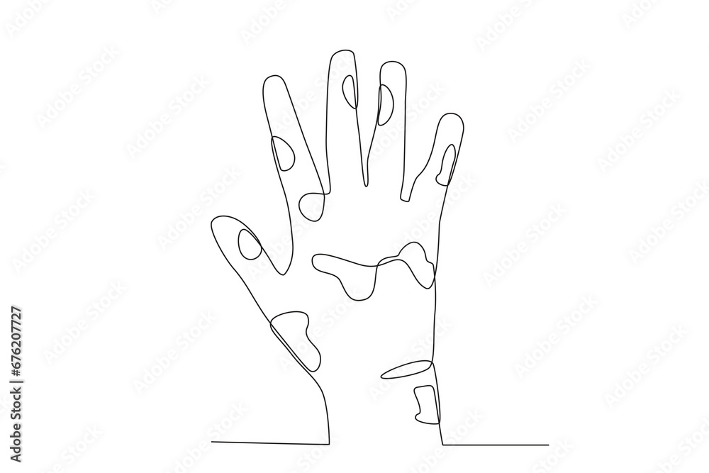 Lesions on the skin of lepers. World Leprosy Day one-line drawing Lesions on the skin of lepers. World Leprosy Day one-line drawing