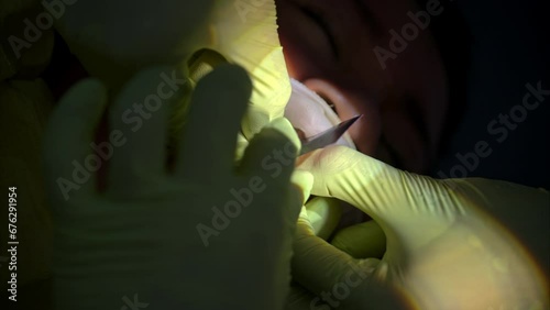 Slow motion vertical shot of a dentist wearing green latex using articulating paper to check the fit of set of composite veneers photo