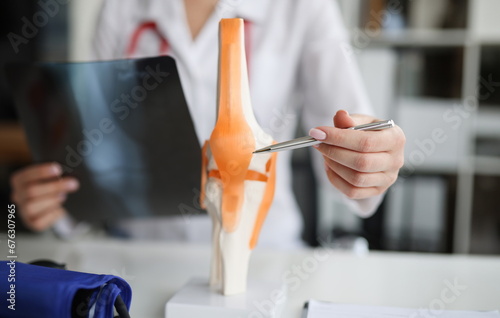 Doctor traumatologist examines x-ray and legs and the model of knee joint. Injuries and sprains concept