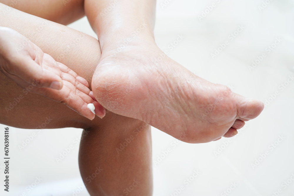 Fototapeta premium Asian woman care feet with crack and dry heel skin, treat and repair with moisturizing cream.