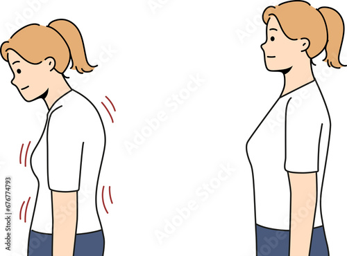 Stooped woman before and after correcting posture thanks to massage therapist or chiropractor photo