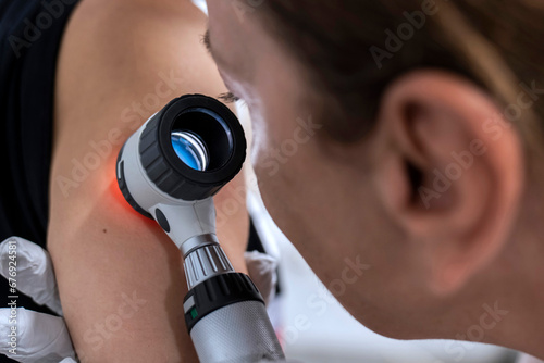 dermatologist examines birthmarks on the patient's skin with a dermatoscope. Dermatology, skin mole examining. looking for signs of melonoma or skin cancer. photo