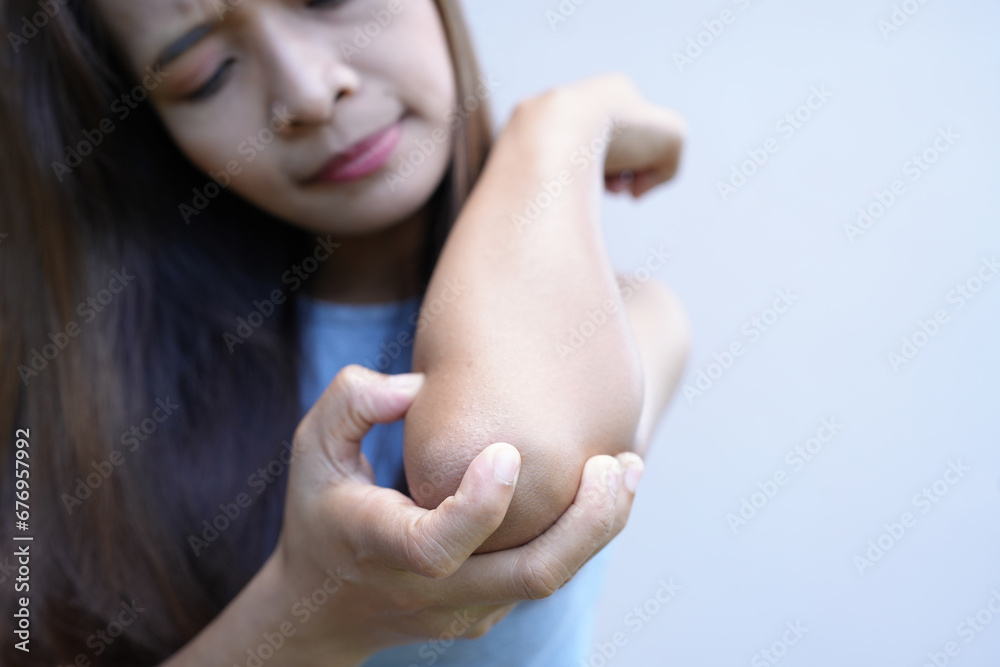 Naklejka premium Asian woman has itching on her arms.