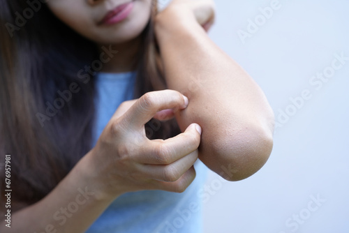 Asian woman has itching on her  arms. photo