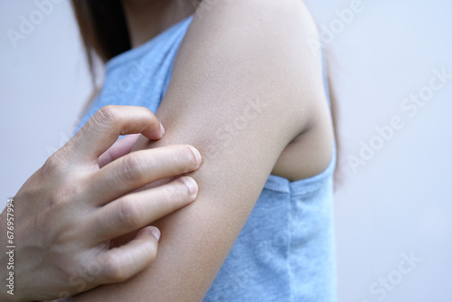 Asian woman has itching on her arms.
