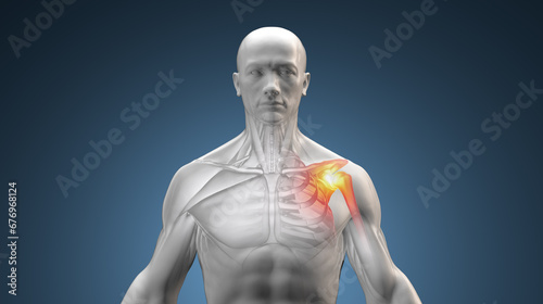 Human male with shoulder joint pain