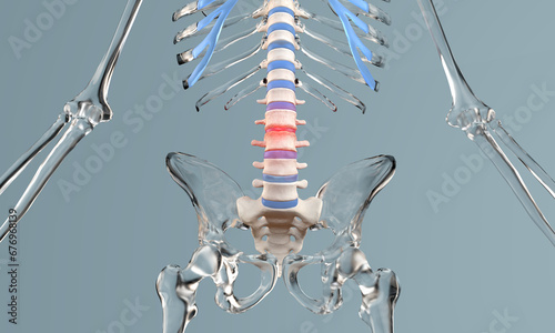 Stenosis of the lumbar spine in glass skeleton photo