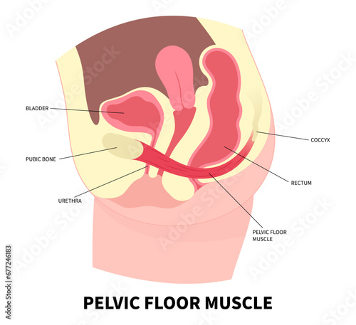 Uterine prolapse with pelvic floor muscles weakness anatomy and reproductive system the training for constipation photo