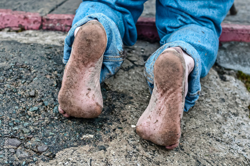 The feet of a man who has just climbed Croagh Patrick barefoot as he prays at the top. photo
