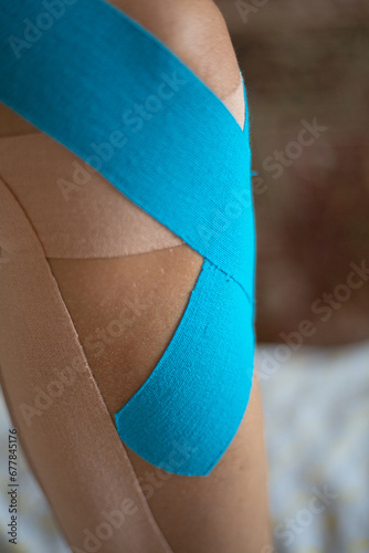 tape on the knee