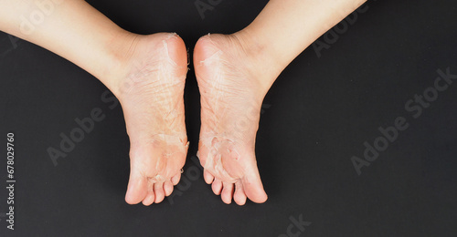 Foot peeling or remove dead skin on black background.