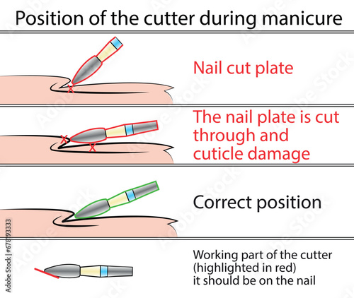 Illustration with hardware manicure technology. Cutter position. Educational material on vector
